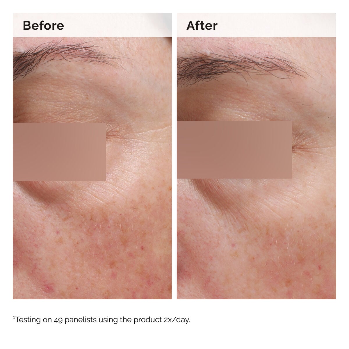 niacinamide-5-face-and-body-emulsion-h6 2024-08-23-ORD-Nia-5pct-Face-Body-B-A-Elasticity-Global-02-1x1.jpg