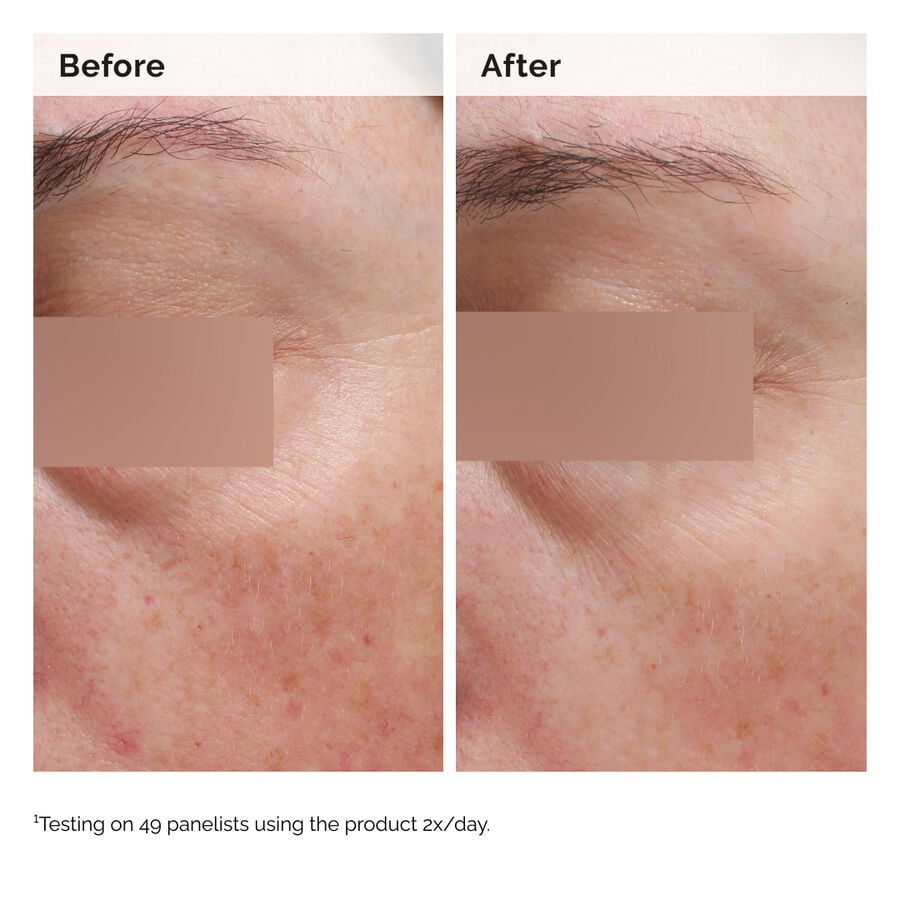 niacinamide-5-face-and-body-emulsion-h6 2024-08-23-ORD-Nia-5pct-Face-Body-B-A-Elasticity-Global-02-1x1.jpg
