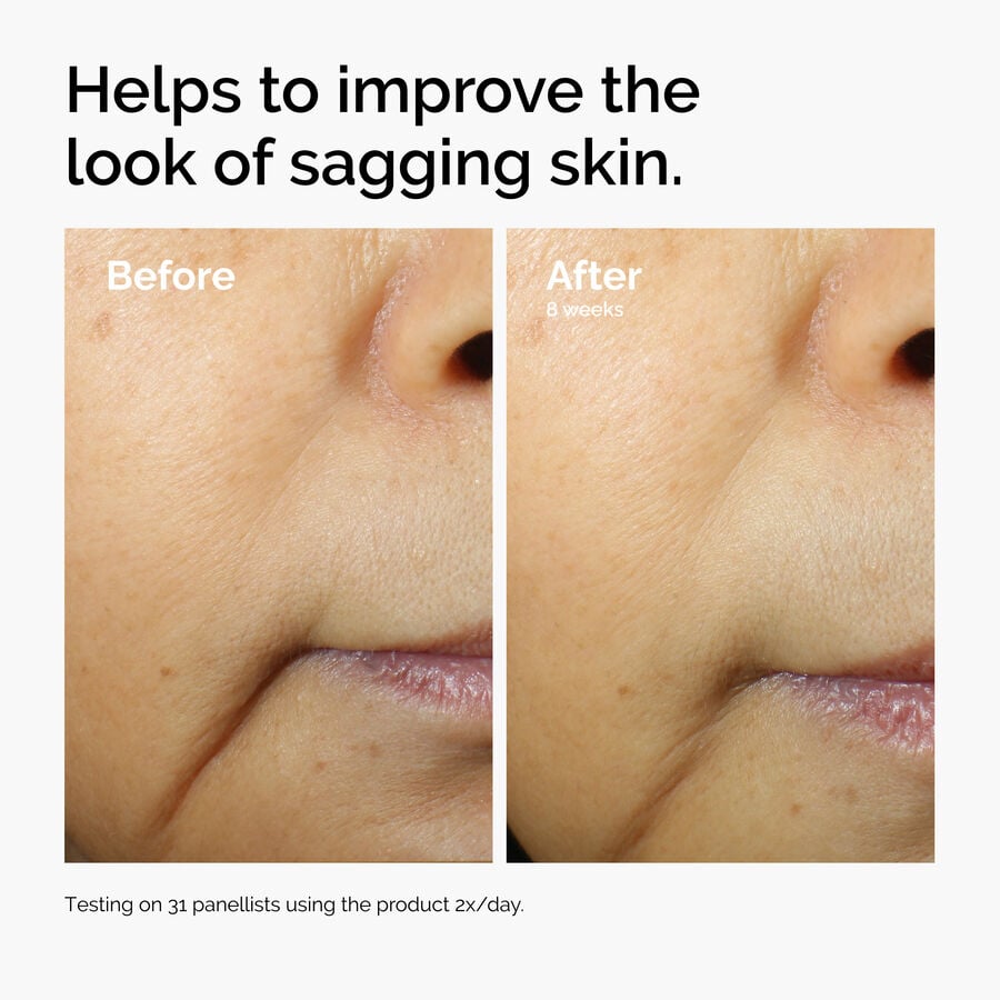 caffeine-3-escin-1-face-serum-g3 ord-caffeine-3pct-escin-1pct-face-serum-before-after-sagging.jpg