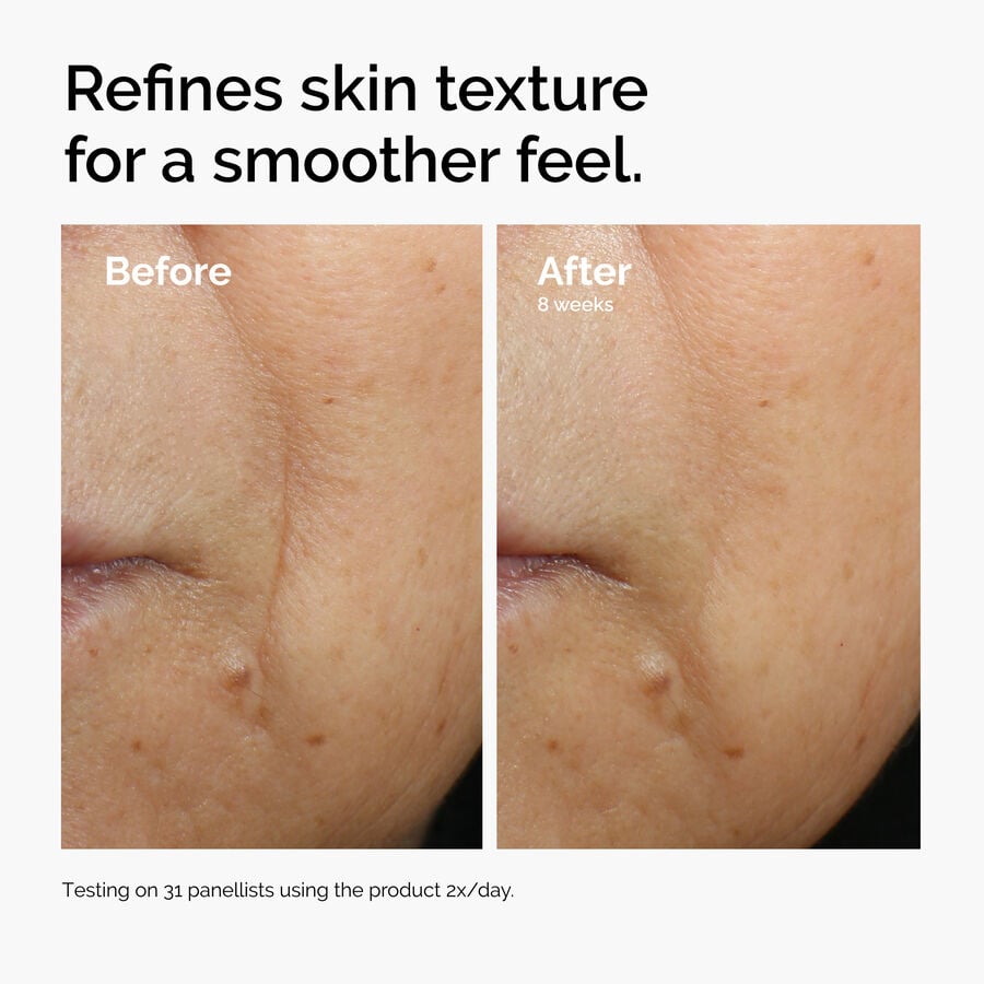 caffeine-3-escin-1-face-serum-g3 ord-caffeine-3pct-escin-1pct-face-serum-before-after-texture.jpg