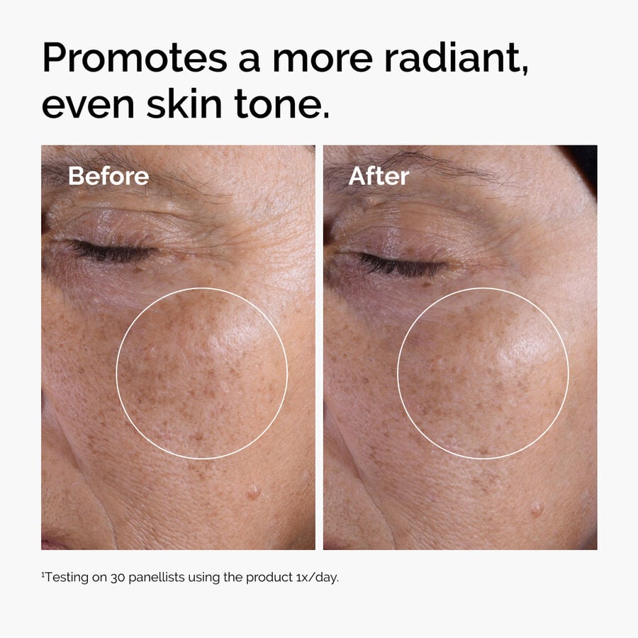 glycolic-acid-7-exfoliating-toner-r9 ord-glycolic-before-after-radiance.jpg