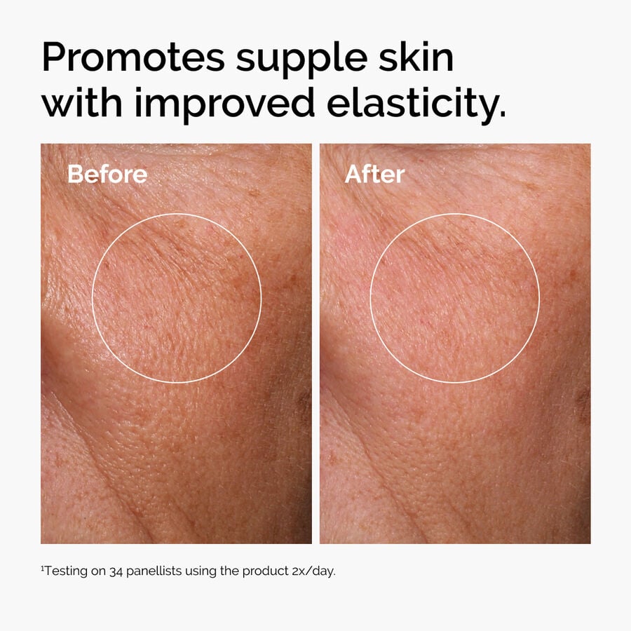 hyaluronic-acid-2-b5-with-ceramides-z4 ord-hyaluronic-acid-2pct-b5-hydrating-serum-before-after-elasticity.jpg
