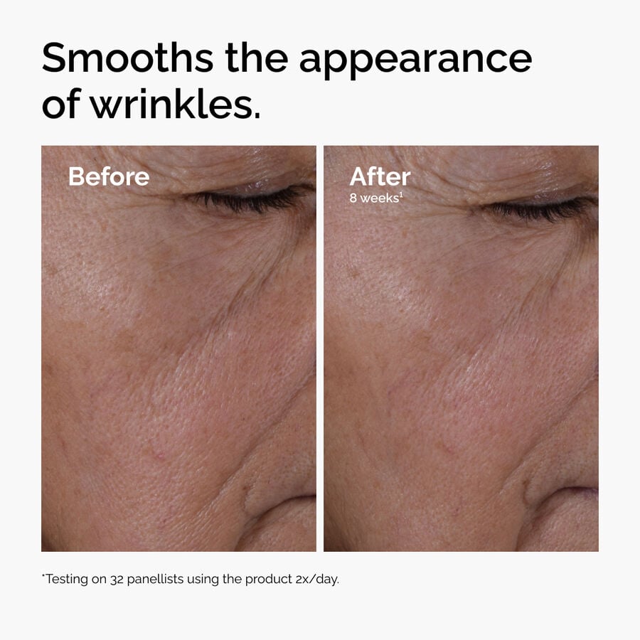 multi-peptide-ha-serum-f0 ord-multi-peptide-ha-serum-wrinkles-before-after.jpg
