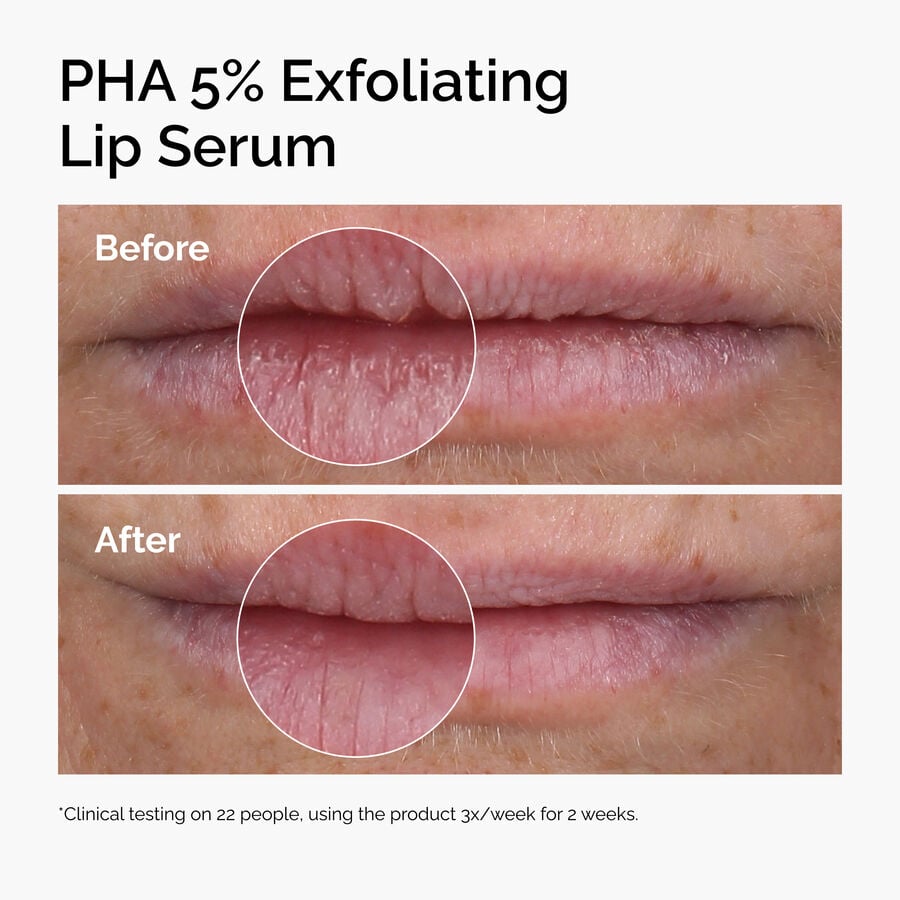 pha-5-exfoliating-lip-serum-c3 ord-pha-5pct-lip-exfoliating-serum-before-after.jpg