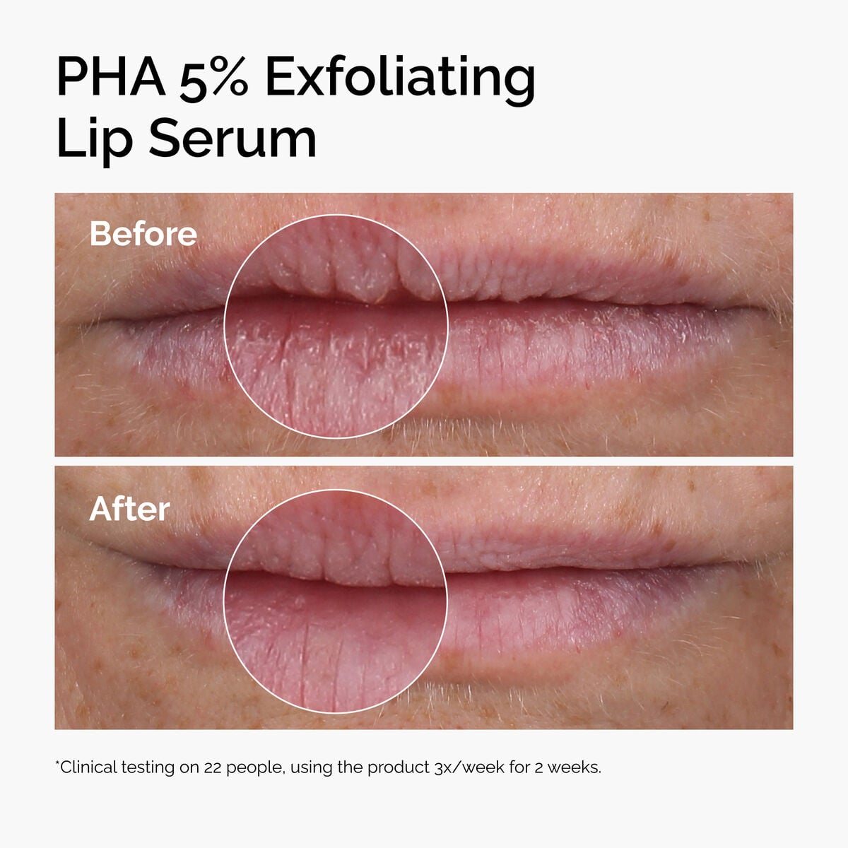 pha-5-exfoliating-lip-serum-c3 ord-pha-5pct-lip-exfoliating-serum-before-after.jpg