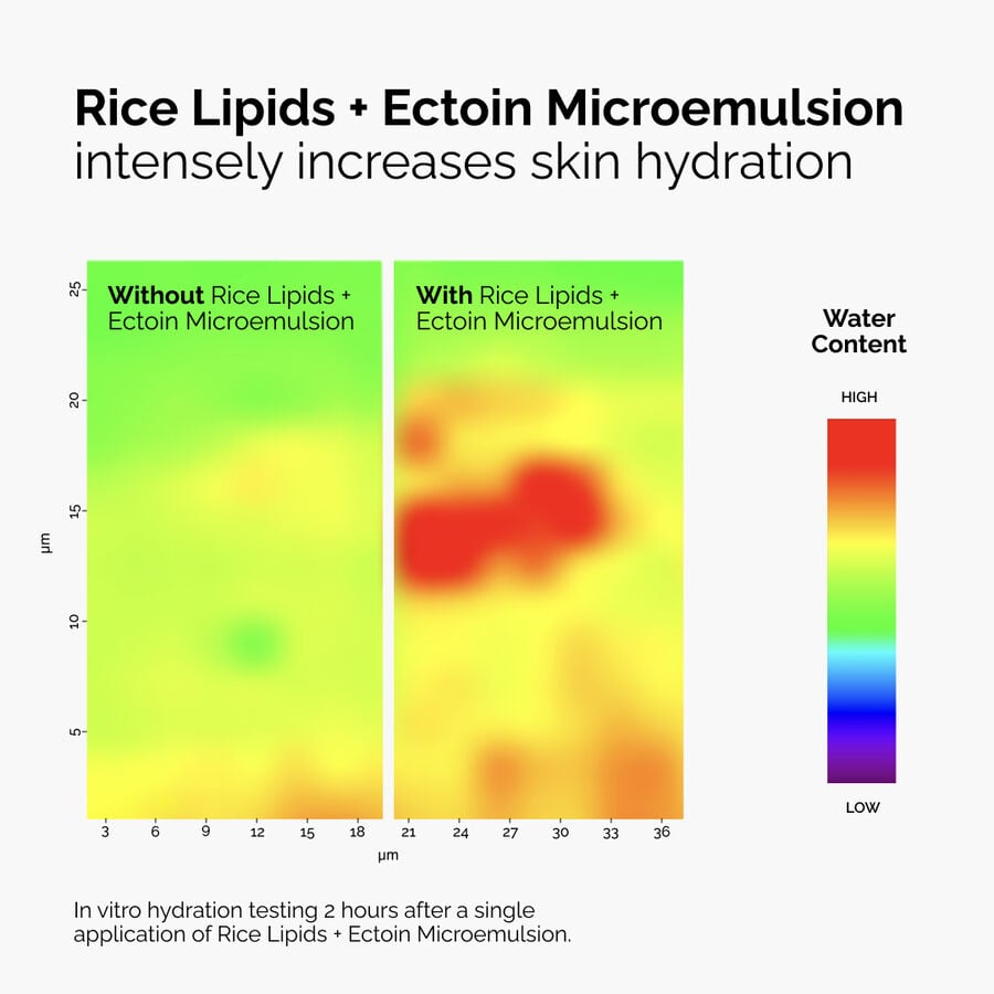 rice-lipids-ectoin-microemulsion-z9 ord-rice-lipids-ectoin-microemulsion-thermal-before-after.jpg