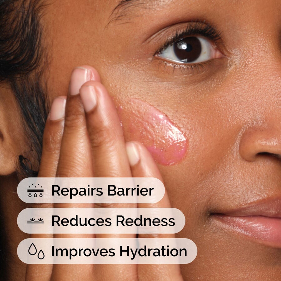 soothing-and-barrier-support-serum-set-q8 ord-soothing-barrier-support-serum-model-application-with-benefits.jpg