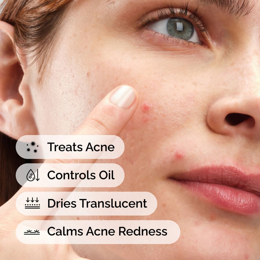 sulfur-10-powder-to-cream-concentrate-k2 ord-sulfur-10pct-powder-to-cream-concentrate-model-application-with-benefits-acne.jpg